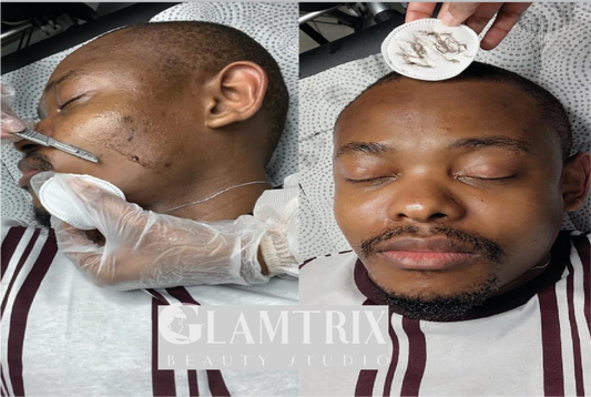 In-Studio FACIALS / DERMAPLANING